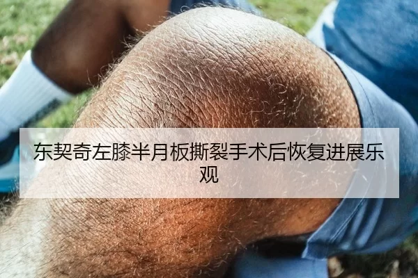 东契奇左膝半月板撕裂手术后恢复进展乐观